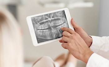 Dentist looking at x rays of teeth on tablet computer