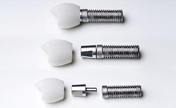 Each dental implant part has a separate cost