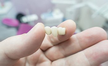 A closeup of a dental bridge held in a person’s hand