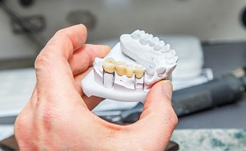 A dental bridge held in a mock jaw