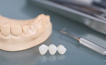 A traditional dental bridge next to a jaw mockup and a dental too