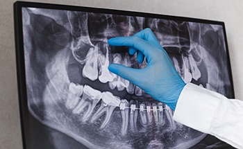 a dentist pointing at an X-ray