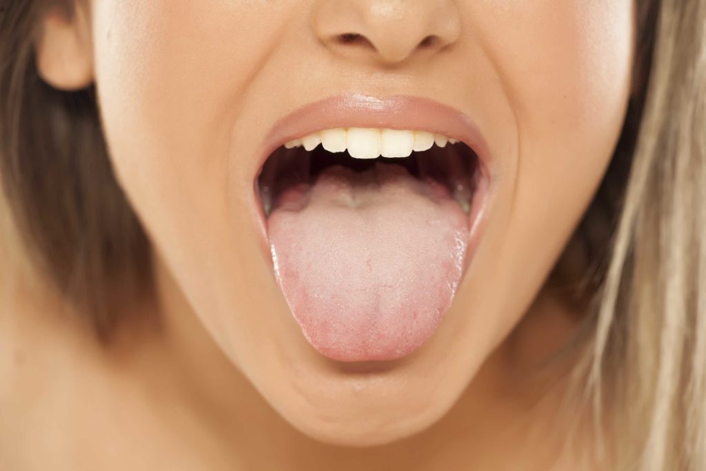 family-dentist-discusses-4-types-of-tongue-trouble-to-watch-for